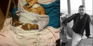 فلسطيني فُقدت عينه وتضررت رئته بتفجير بئر حسن..