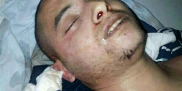 »شاهد« تشعر بقلق شديد إزاء مقتل شاب في مخيم الرشيدية تحت التعذيب وتدعو لفتح تحقيق عاجل